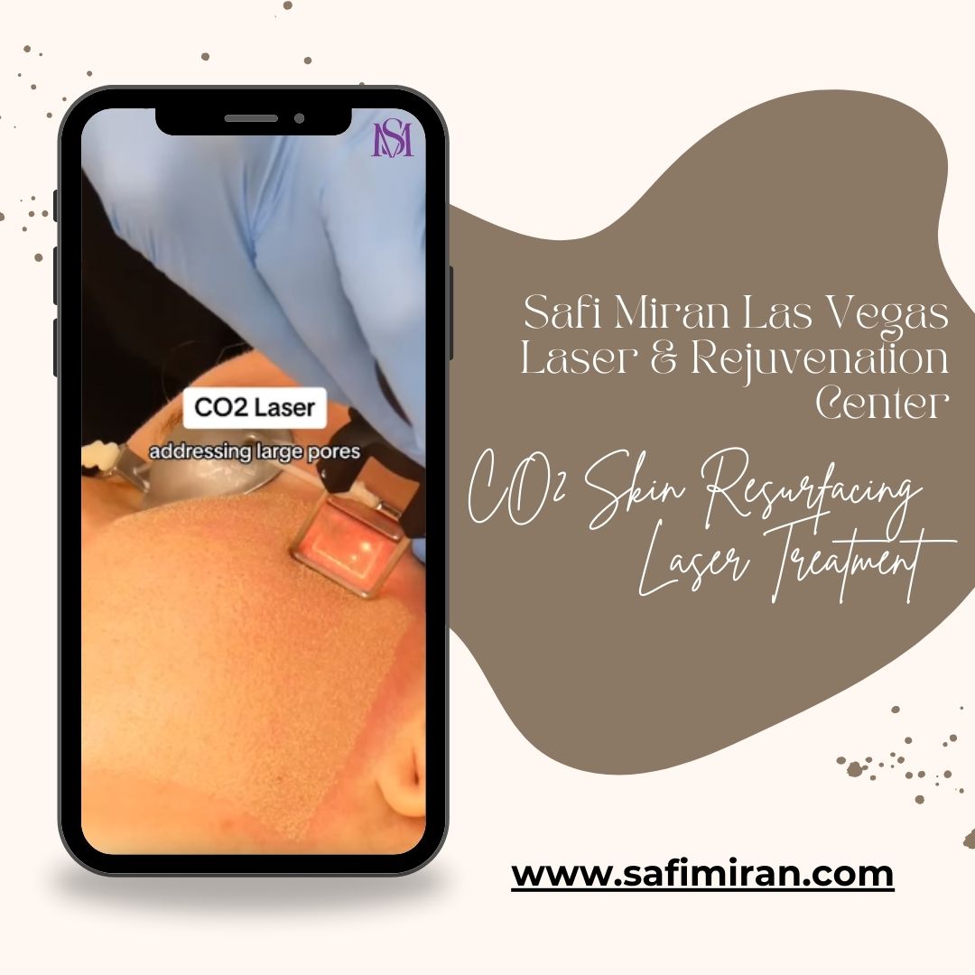 co2 skin resurfacing laser treatment Las Vegas
